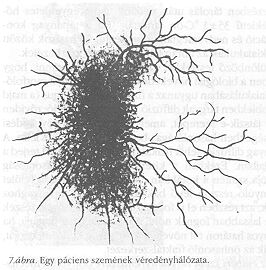 7. �bra