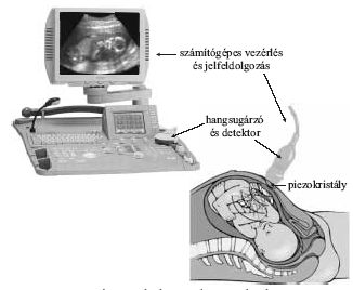 1. ábra. Az ultrahangos diagnosztika elve