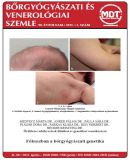 Az archiv�lt  verzi� megnyit�sa Open the archive version
